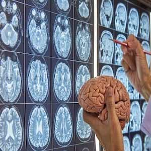 Neuroscience