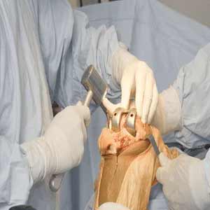 Orthopaedic